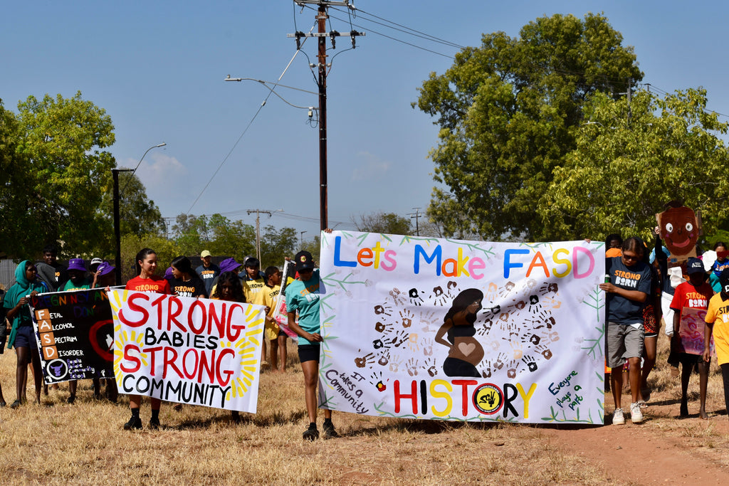 Fitzroy Valley comes together for FASD Awareness Day 2026